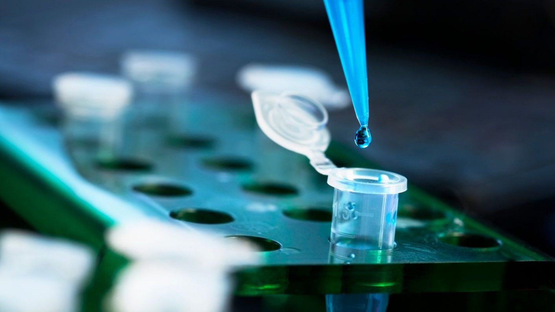 Human tuberculosis ELISA — laboratory setting